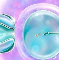 男性不育，没有精子 男性不孕,想试管婴儿