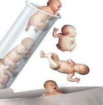 怎样提高试管婴儿的促排效果?