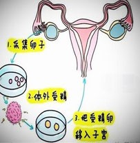 试管婴儿和正常怀孕的孩子有什么区别